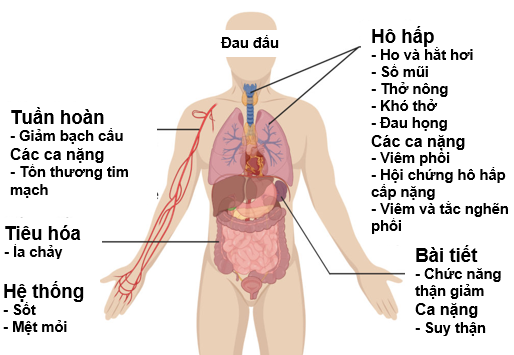 Các triệu chứng nhiễm COVID-19