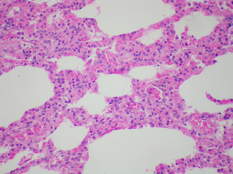 Hình ảnh của Respiratory syncytial virus - RSV