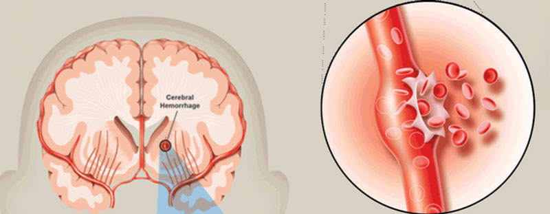 Chụp cộng hưởng từ não