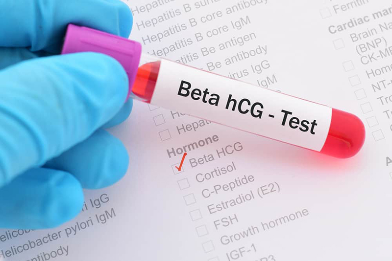 xét nghiệm beta hcg