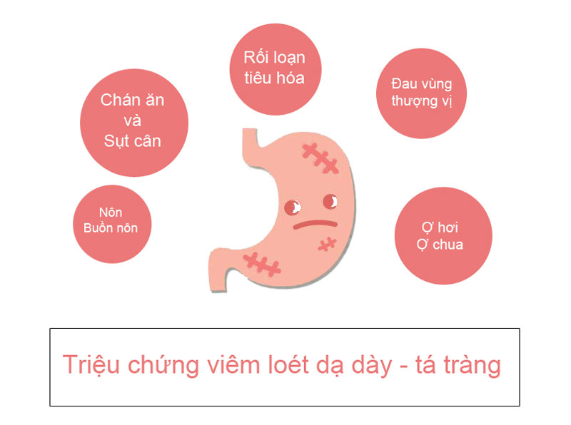 loét dạ dày