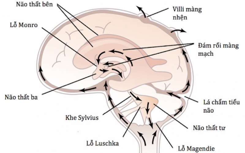 CSF là một chất lỏng trong suốt trong khoang dưới nhện, não thất và tủy sống