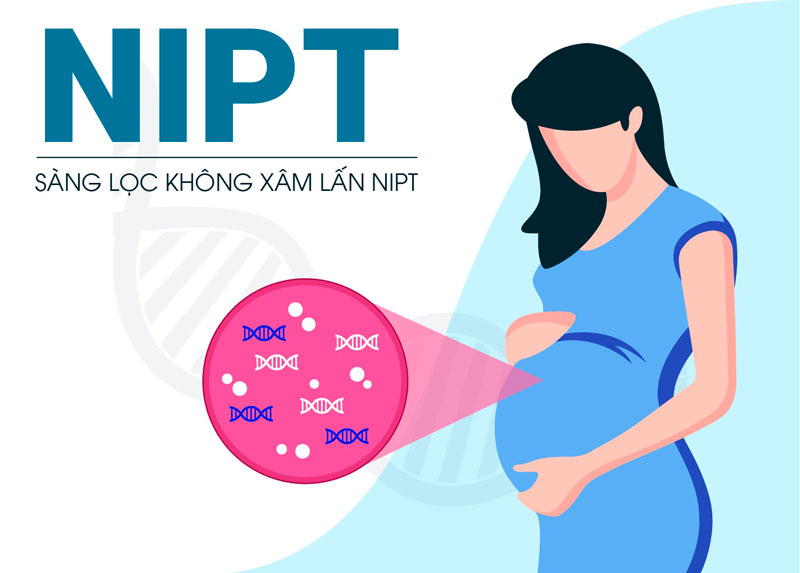 NIPT là cách thức sàng lọc không xâm lấn