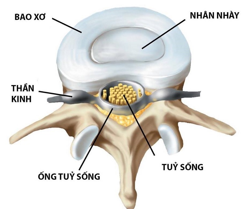 Cấu tạo đĩa đệm gồm nhân nhầy và các vòng sợi