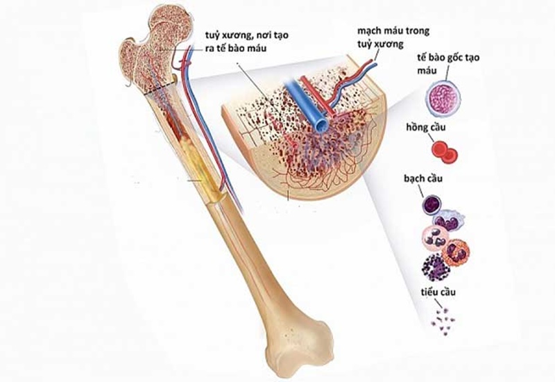 Suy tủy cũng có thể gây ra tình trạng da nổi chấm đỏ