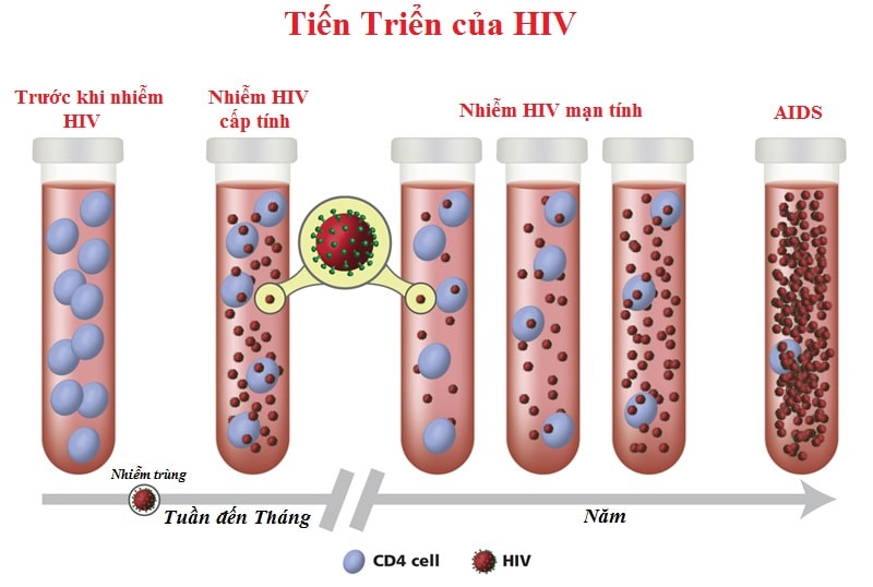 HIV - căn bệnh nguy hiểm nhất trong các bệnh lây qua đường tình dục