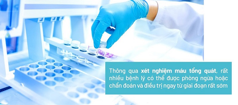 Xét nghiệm máu rất cần thiết để phát hiện và chẩn đoán bệnh