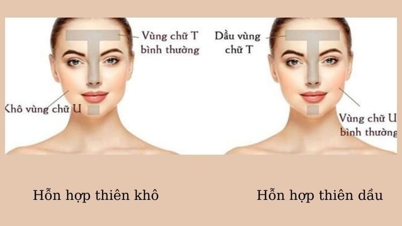 Người có làn da hỗn hợp cần biết da thiên khô hay thiên dầu để chọn sản phẩm dưỡng ẩm phù hợp