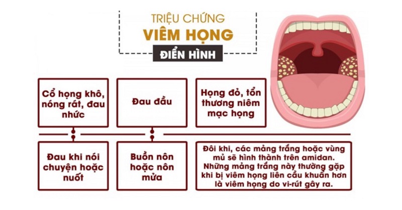 Các triệu chứng chung thường gặp ở bệnh viêm họng cấp