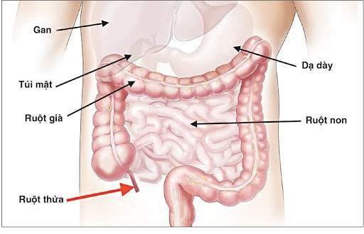 chẩn đoán viêm ruột thừa