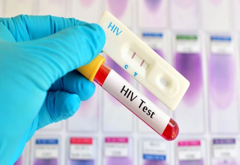 Để chẩn đoán chính xác xem một người có đang bị nhiễm HIV hay không thì xét nghiệm là hình thức hiệu quả nhất