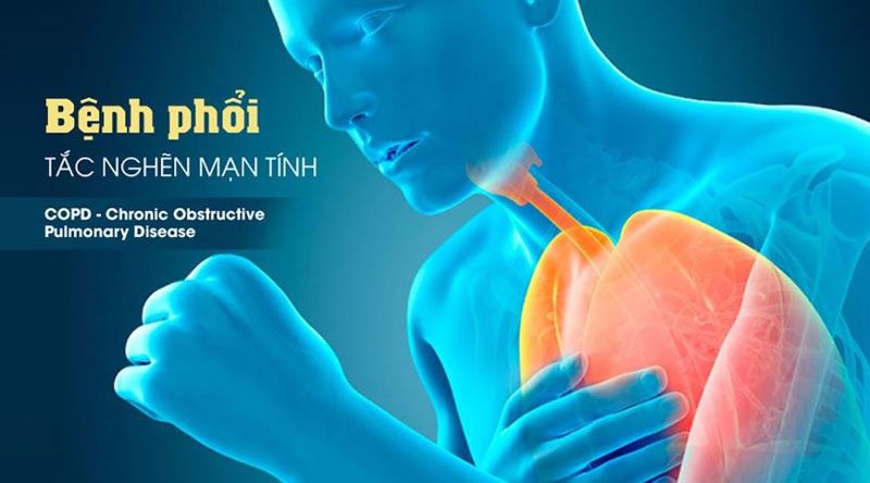 Bệnh phổi tắc nghẽn mạn tính thường xảy ra với nam giới trên 40 tuổi