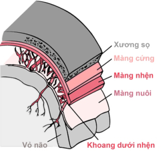 viêm màng não