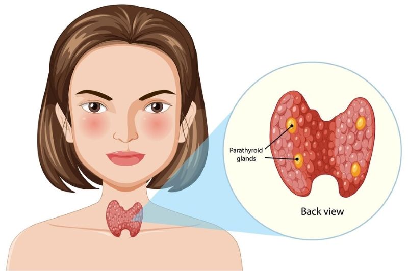 U tuyến giáp hay còn lại là các nốt, hạt hoặc nhân tuyến giáp 