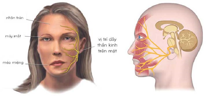 Bài tập liệt dây thần kinh số 7 tác động cải thiện, kích thích cơ mặt để phục hồi chức năng cho người bệnh