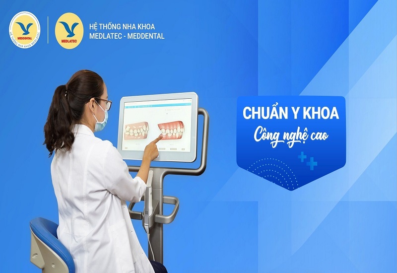 Hệ thống Nha khoa MEDDENTAL - Địa chỉ uy tín để khôi phục hàm răng đã mất