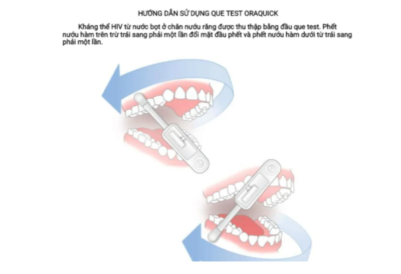 Hướng dẫn cách lấy mẫu bệnh phẩm xét nghiệm HIV bằng dịch miệng