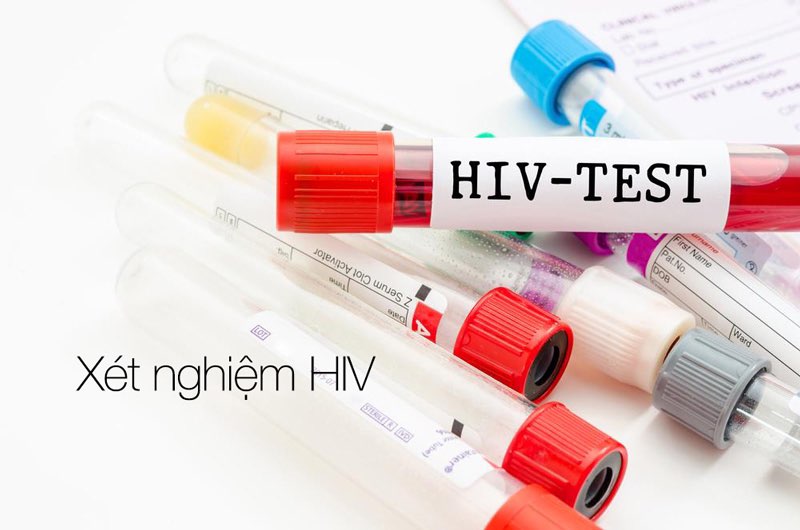 Xét nghiệm là cách duy nhất để khẳng định chắc chắn một người có bị nhiễm HIV không